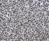 Anti-Human CMTM2 Antibody - ABMIUM