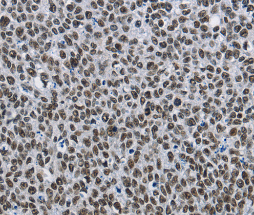 Anti-Human CMTM2 Antibody - ABMIUM