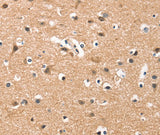 Anti-Human/Mouse/Rat HDAC8 Antibody - ABMIUM