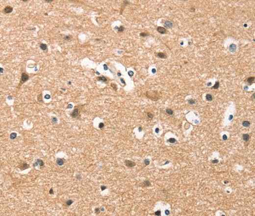 Anti-Human/Mouse/Rat HDAC8 Antibody