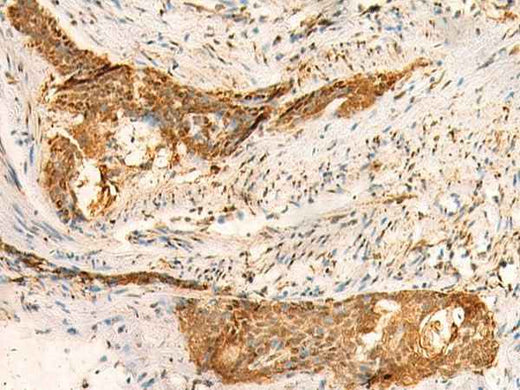 Anti-Human/Mouse/Rat SMUG1 Antibody