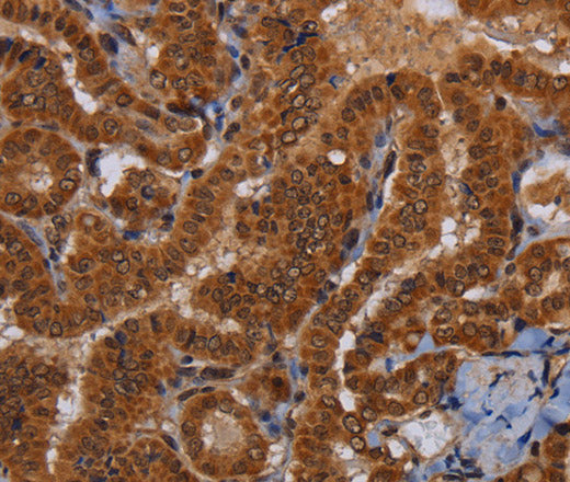 Anti-Human/Mouse/Rat WDR83 Antibody - ABMIUM