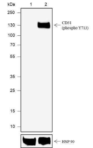 Anti-Human Phospho-CD31 (Tyr713) Antibody [A817] - ABMIUM