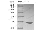 Recombinant Human SUMO3/SMT3A Protein (His Tag) - ABMIUM
