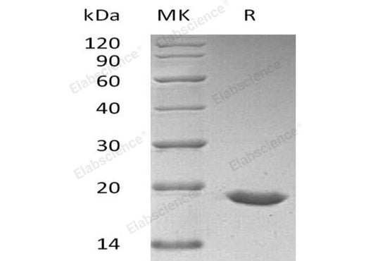Recombinant Human SUMO3/SMT3A Protein (His Tag) - ABMIUM