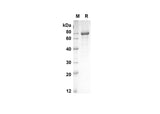 SDS-PAGE analysis of Mouse Tnfrsf11b proteins, 2 μg/lane of Recombinant Mouse Tnfrsf11b proteins was resolved with an SDS-PAGE under reducing conditions, showing bands at 66.7 kDa.