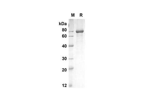 SDS-PAGE analysis of Mouse Tnfrsf11b proteins, 2 μg/lane of Recombinant Mouse Tnfrsf11b proteins was resolved with an SDS-PAGE under reducing conditions, showing bands at 66.7 kDa.