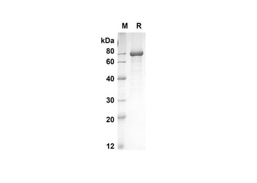 SDS-PAGE analysis of Mouse Tnfrsf11b proteins, 2 μg/lane of Recombinant Mouse Tnfrsf11b proteins was resolved with an SDS-PAGE under reducing conditions, showing bands at 66.7 kDa.