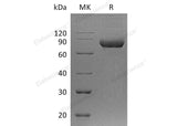 Recombinant Human IL5RA/IL-5 Rα Protein (Fc Tag) - ABMIUM