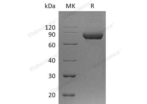 Recombinant Human IL5RA/IL-5 Rα Protein (Fc Tag) - ABMIUM