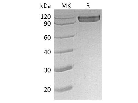 Recombinant Human CD30/TNFRSF8 Protein (Fc Tag) - ABMIUM