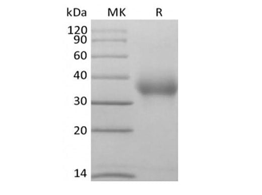 Recombinant Human CD47/IAP/OA3 (C-Avi-6His) Biotinylated - ABMIUM