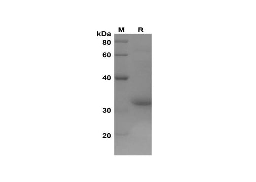 SDS-PAGE analysis of Human ACSL4 proteins, 2 μg/lane of Recombinant Human ACSL4 proteins was resolved with SDS-PAGE under reducing conditions, showing bands at 32 kDa.