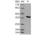 > 92 % as determined by reducing SDS-PAGE.