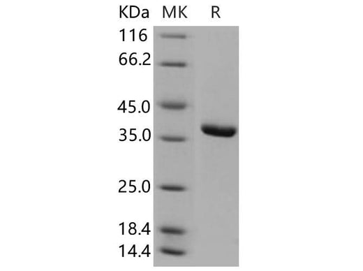 > 92 % as determined by reducing SDS-PAGE.