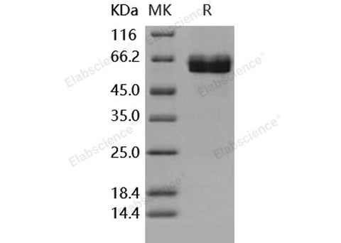 Recombinant Human ACVR2B/ActivinR-IIB Protein (Fc Tag) - ABMIUM