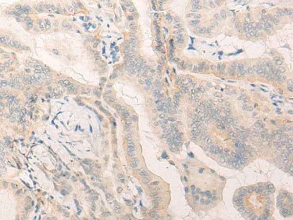Anti-Human ELANE Antibody