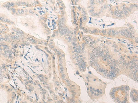 Anti-Human ELANE Antibody - ABMIUM
