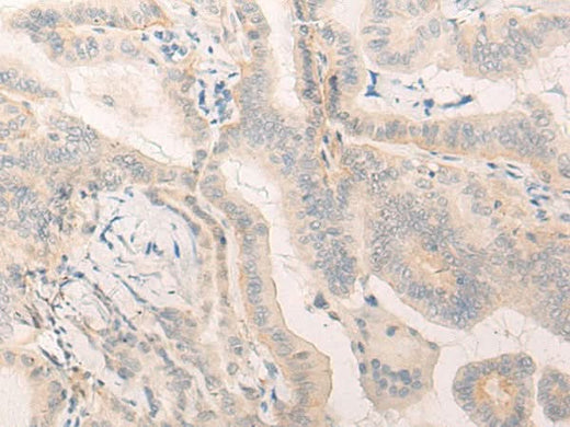 Anti-Human ELANE Antibody - ABMIUM