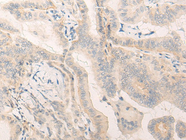 Anti-Human ELANE Antibody - ABMIUM