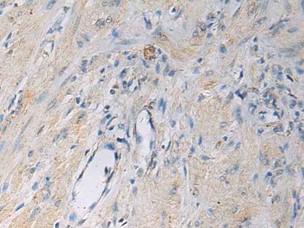 Anti-Human HSDL2 Antibody