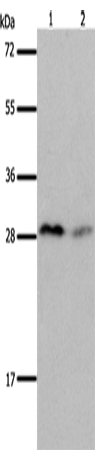 Anti-Human/Mouse KLK7 Antibody - ABMIUM