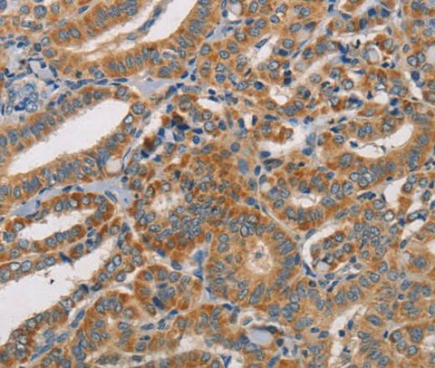 Anti-Human CDK11A/CDK11B Antibody - ABMIUM