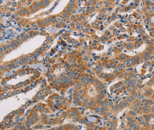 Anti-Human CDK11A/CDK11B Antibody - ABMIUM