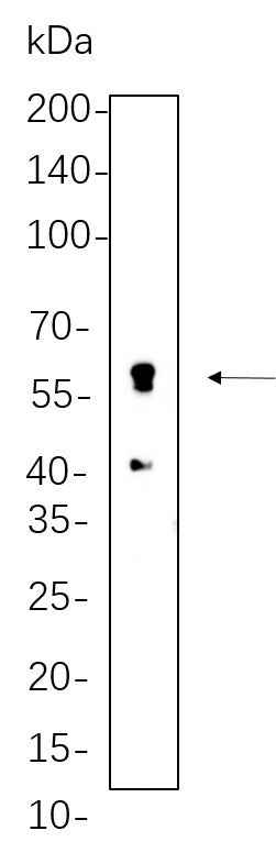 Anti-Human/Mouse/Rat Perilipin-1 Antibody [B1127]