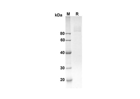 SDS-PAGE analysis of Human GP4/CD36 proteins, 2 μg/lane of Recombinant Human GP4/CD36 proteins was resolved with an SDS-PAGE under reducing conditions, showing bands at 69.9 kDa.