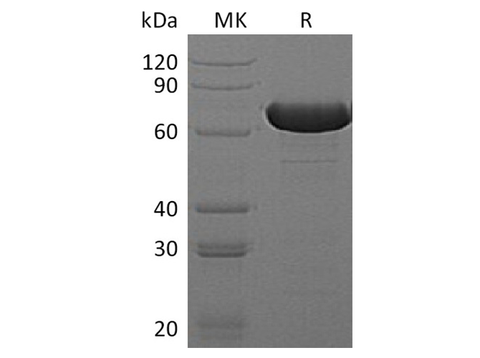 Recombinant E.coli Beta-Glucuronidase/Uida/Beta-Gus Protein (His Tag) - ABMIUM