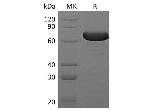 Recombinant E.coli Beta-Glucuronidase/Uida/Beta-Gus Protein (His Tag) - ABMIUM