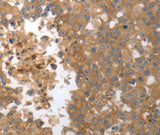 Anti-Human MMP27 Antibody - ABMIUM