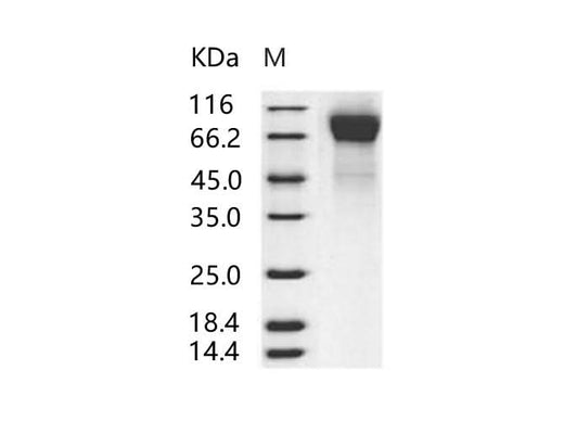 Recombinant Human RSV (B1) glycoprotein G / RSV-G Protein (His Tag) - ABMIUM