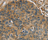 Anti-Human RIPK4 Antibody - ABMIUM