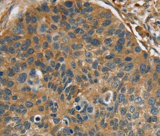 Anti-Human RIPK4 Antibody
