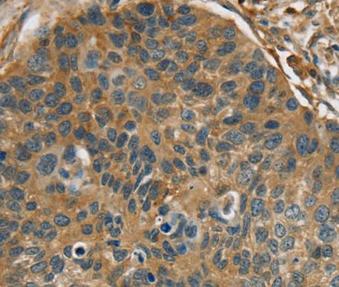 Anti-Human RIPK4 Antibody - ABMIUM