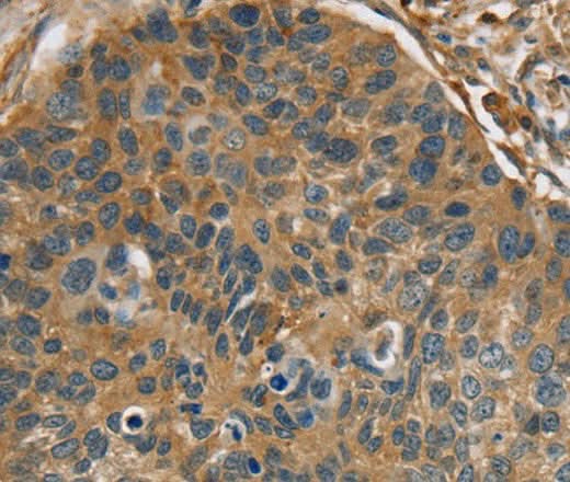 Anti-Human RIPK4 Antibody - ABMIUM