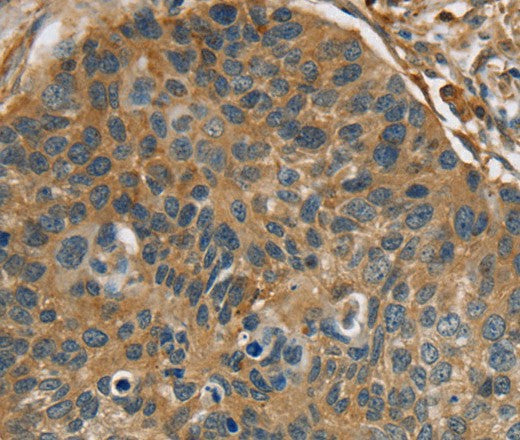 Anti-Human RIPK4 Antibody - ABMIUM