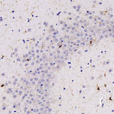 Immunohistochemistry analysis of paraffin-embedded mouse brain using AIF1 Polyclonal Antibody at dilution of 1:300.