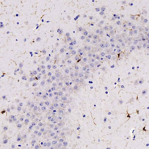 Immunohistochemistry analysis of paraffin-embedded mouse brain using AIF1 Polyclonal Antibody at dilution of 1:300.