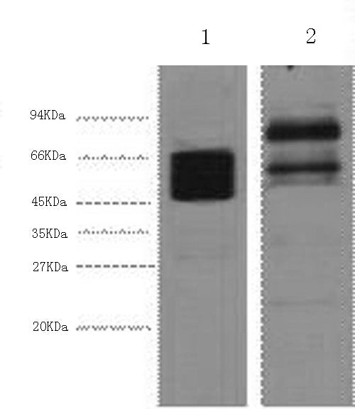 Western Blot analysis of 1) Hela, 2) Mouse brain using CK-8 Monoclonal Antibody at dilution of 1:4000.