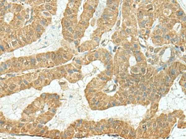 Anti-Human/Mouse/Rat TENT5C Antibody