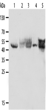 Anti-Human/Mouse/Rat KRT19 Antibody - ABMIUM