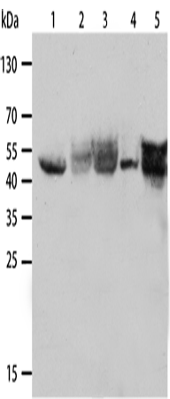 Anti-Human/Mouse/Rat KRT19 Antibody - ABMIUM