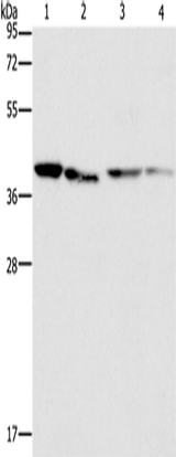 Anti-Human/Mouse/Rat BCAT2 Antibody - ABMIUM