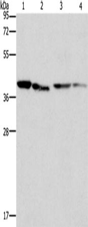 Anti-Human/Mouse/Rat BCAT2 Antibody - ABMIUM