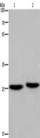 Anti-Human/Mouse/Rat EPDR1 Antibody - ABMIUM