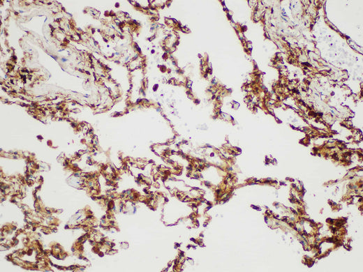 Immunohistochemistry of paraffin-embedded Human lung using S100A4 Polycloanl Antibody at dilution of 1:50.
