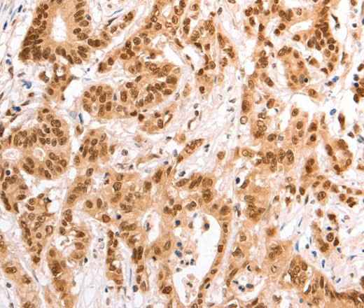 Anti-Human/Mouse/Rat TAX1BP1 Antibody